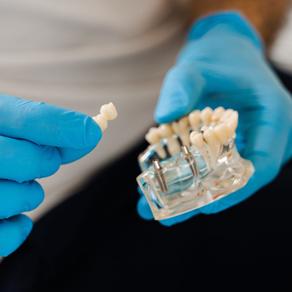 Acacia Dental Group | Implant Dentistry, Dental Fillings and Ceramic Crowns